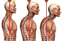 Александр Волоткевич Практические примеры коррекции осанки и фигуры