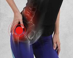 Александр Волоткевич Баланс таза перекос, шифт, наклоны 2025