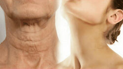 Татьяна Курчина Шея как у королевы 2025