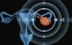 Sigh Energy Восстановление яичников