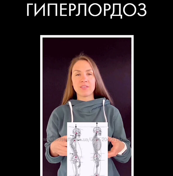 Христина Жарикова - Гиперлордоз
