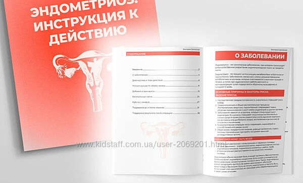 Виктория Орлинская Эндометриоз инструкция к действию 2025